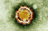 La peur du coronavirus envahit la planète, et qu&#039;en est-il exactement de cette terreur?